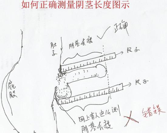 阴茎测量方法